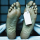 Illustration for article titled On Mouth Breathing, and Other Rare Causes of Death in America